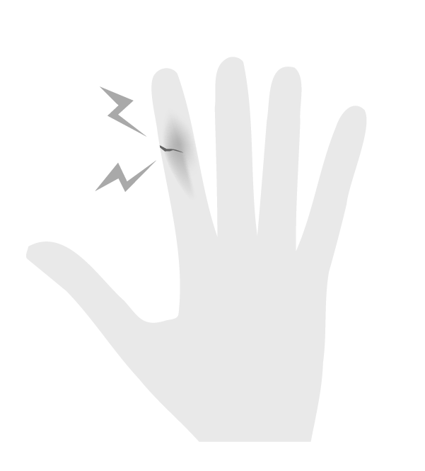 白黒の指の切り傷のイラスト