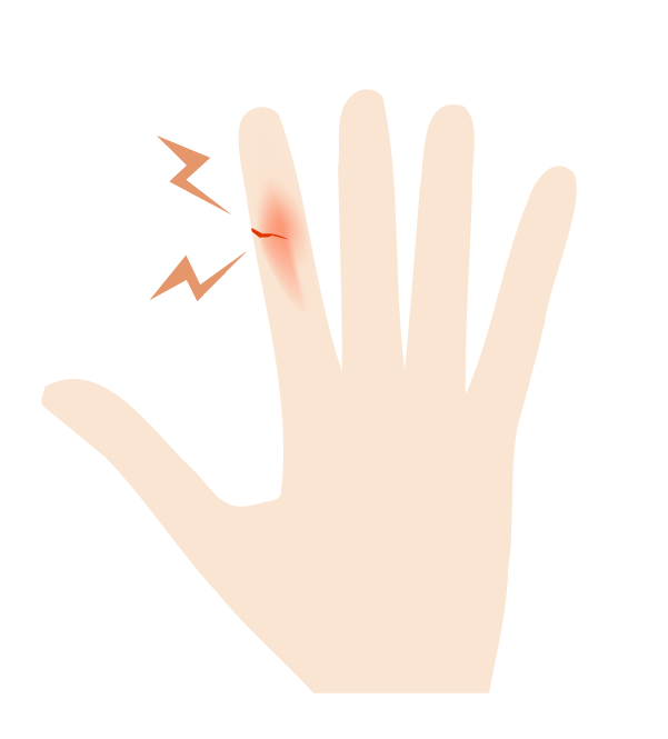 指の切り傷のイラスト